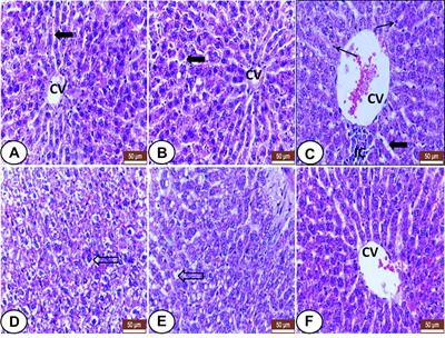 L-Carnitine Mitigates Oxidative Stress and Disorganization of Cytoskeleton Intermediate Filaments in Cisplatin-Induced Hepato-Renal Toxicity in Rats